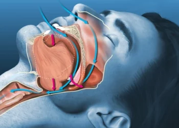 Wellhealthorganic.comif-you-are-troubled-by-snoring-then-know-home-remedies-to-deal-with-snoring