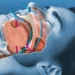 Wellhealthorganic.comif-you-are-troubled-by-snoring-then-know-home-remedies-to-deal-with-snoring