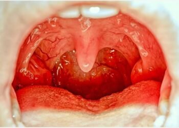 Can Tonsils Grow Back After Being Removed? – Tymoff – An In-Depth Analysis