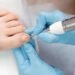 The Science of Foot Health Understanding Common Conditions and Treatments